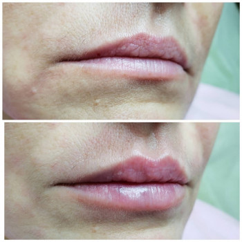 Софія Голуб, Івано-Франківськ Фото - 17