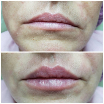 Софія Голуб, Івано-Франківськ Фото - 18