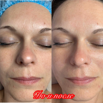 Фото с портфолио Анна Сущенко 