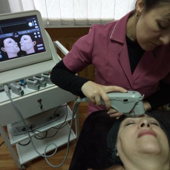 Smas лифтинг Харьков