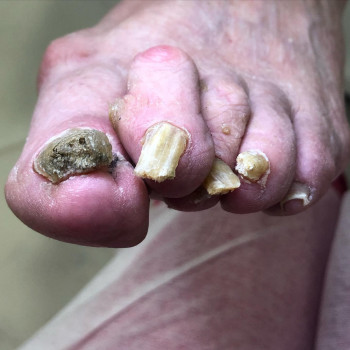 Ольга Черная , Запоріжжя Фото - 5