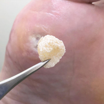 Ольга Черная , Запоріжжя Фото - 7