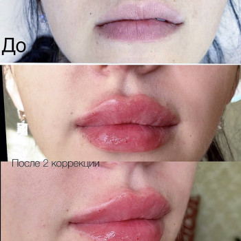 Алёна Орехова , Київ Фото - 5