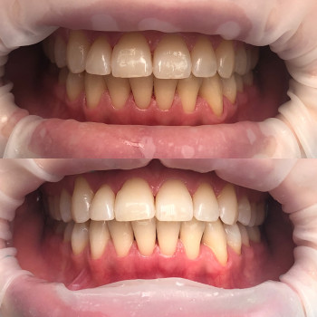 Алёна Орехова , Київ Фото - 6