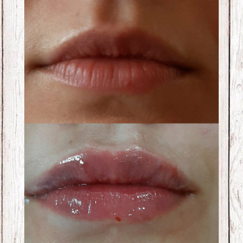 Фото с портфолио Lady's City