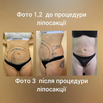 Святослав Ізбенко, Ивано-Франковск Фото - 9