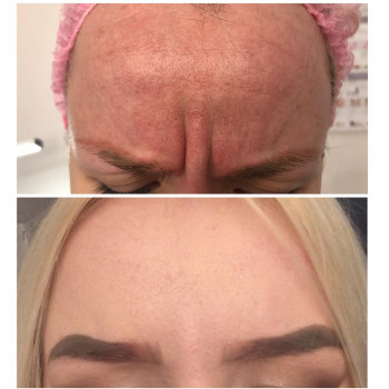 Beautymed Clinic, Запоріжжя Фото - 68