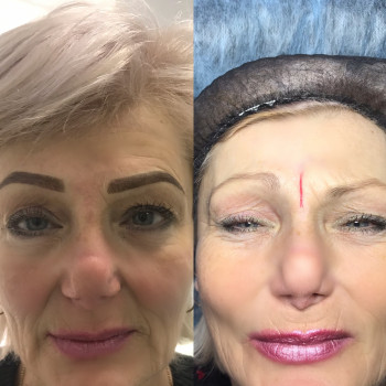 Юліана Лутчин, Ивано-Франковск Фото - 17