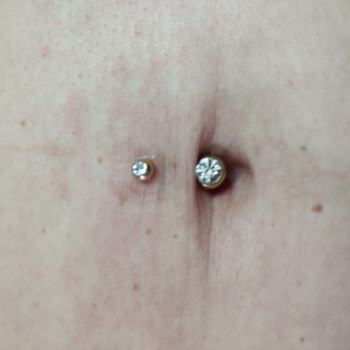 Прокол пупка