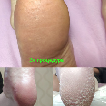 Фото с портфолио Евгения Федирко