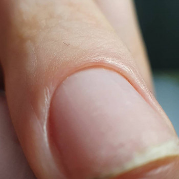 Наталія Мошківська , Житомир Фото - 9