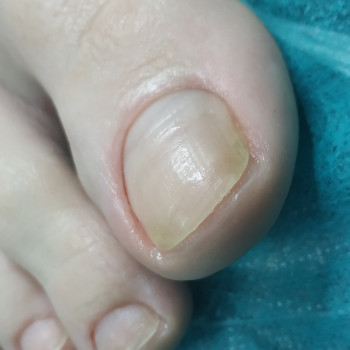 Наталія Мошківська , Житомир Фото - 21