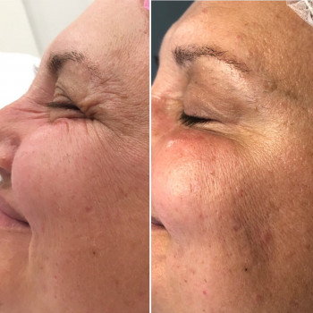 Ларанж, Одесса Фото - 35