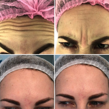 Ларанж, Одесса Фото - 37