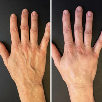 Екатерина Дмитриева, Київ Фото - 12