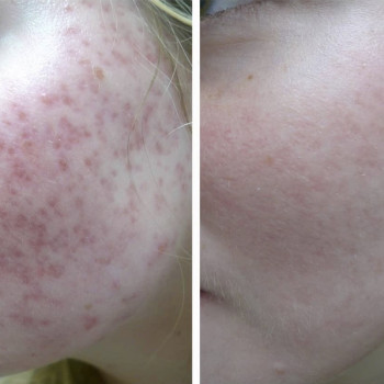 Фото с портфолио Екатерина Дмитриева