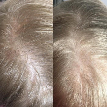 Алена Птуха , Чернигов Фото - 19