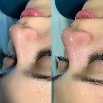 Алена Птуха , Чернигов Фото - 6