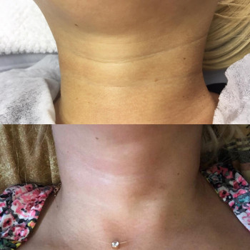 Алена Птуха , Чернигов Фото - 8