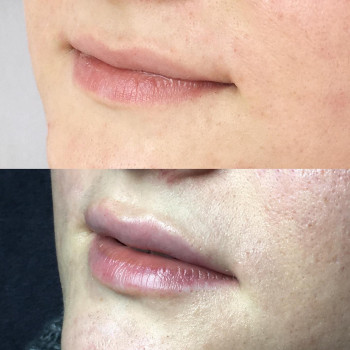 Алена Птуха , Чернигов Фото - 2