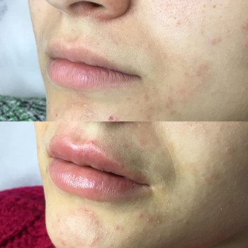 Алена Птуха , Чернигов Фото - 12