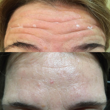 Алена Птуха , Чернигов Фото - 13