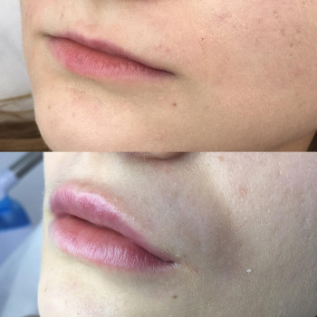 Алена Птуха , Чернигов Фото - 14