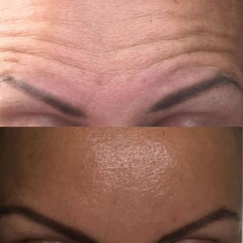 Алена Птуха , Чернигов Фото - 15