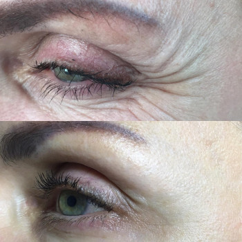 Алена Птуха , Чернигов Фото - 16