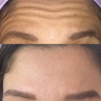 Алена Птуха , Чернигов Фото - 17