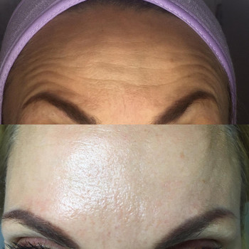 Алена Птуха , Чернигов Фото - 27