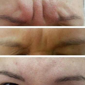 Ірина Литвінова, Херсон Фото - 36