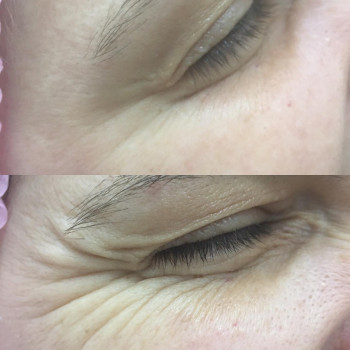 Ірина Литвінова, Херсон Фото - 33