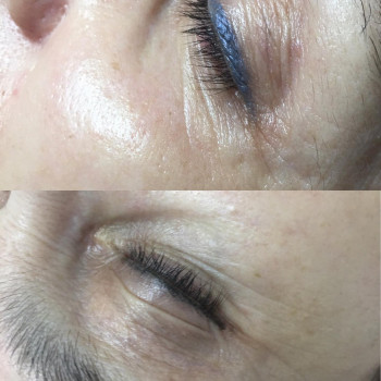 Ірина Литвінова, Херсон Фото - 38