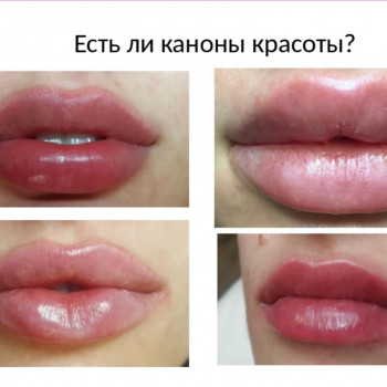 Ірина Литвінова, Херсон Фото - 39