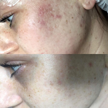 Ірина Литвінова, Херсон Фото - 34