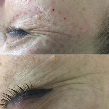 Ірина Литвінова, Херсон Фото - 32