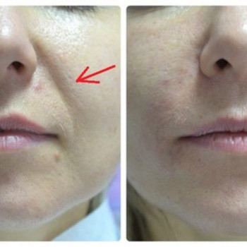 Ірина Литвінова, Херсон Фото - 7