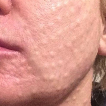 Ірина Литвінова, Херсон Фото - 8