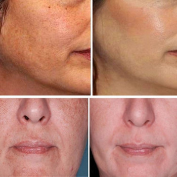 Ірина Литвінова, Херсон Фото - 2