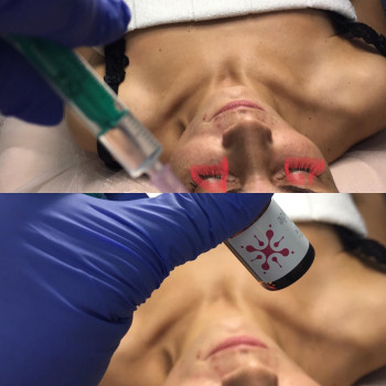 Ірина Литвінова, Херсон Фото - 15