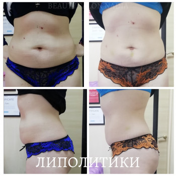 Надія, Кривой Рог Фото - 12