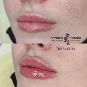 Эстетик Сенсей, Київ Фото - 23