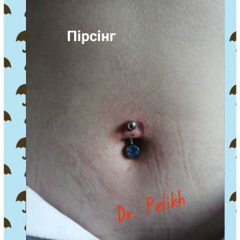 Beauty clinic Dr.Pelikh, Хмельницький Фото - 31