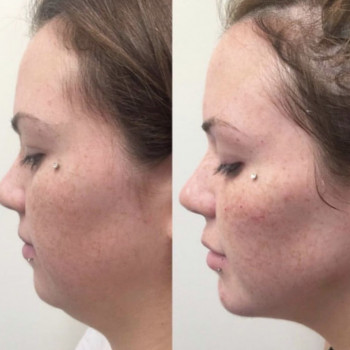 Фото с портфолио Екатерина Дмитриева