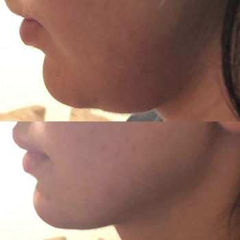 Екатерина Дмитриева, Київ Фото - 15