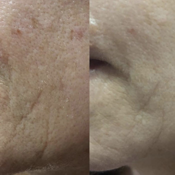 Фото с портфолио Екатерина Дмитриева