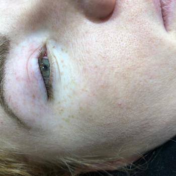 Перманентний макіяж стрілочки (міжвійкова, класична, з розтушовкою)
                    Майстер перманентного макіяжу Марина Мороз Львів