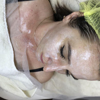 Доглядова процедура