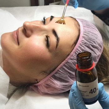 Фото з портфоліо косметолога Тетяна Савва (Львів)